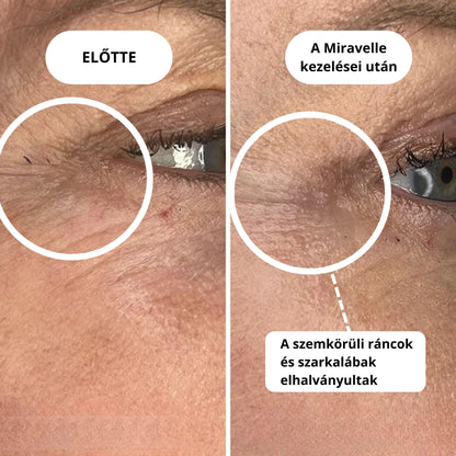 Micro-Infúziós kezelés