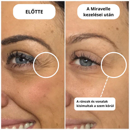Micro-Infúziós kezelés