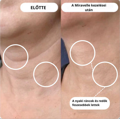 Micro-Infúziós kezelés